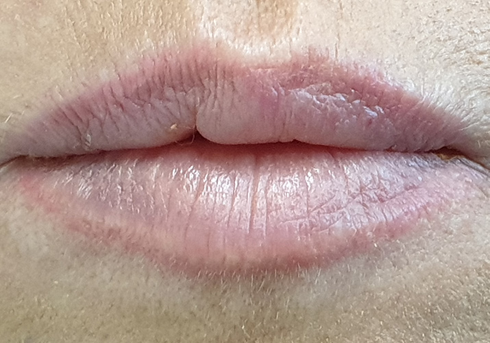 הסרת איפור קבוע שפתיים אחרי